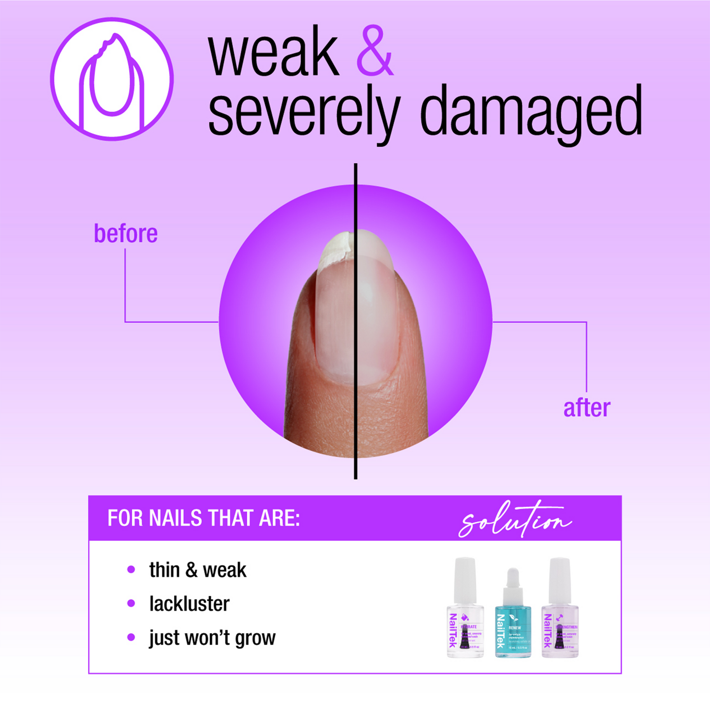 Nail Tek Nail Rescue System