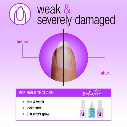 Nail Tek Nail Rescue System